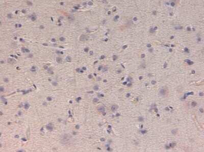 Immunohistochemistry: Kinesin 5B Antibody [NBP2-21667] - Immunohistochemistry of Kinesin 5B antibody. Tissue: Human Brain at 40X at pH 6.